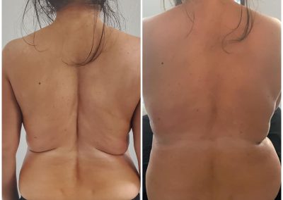 Organic Spray Tanning