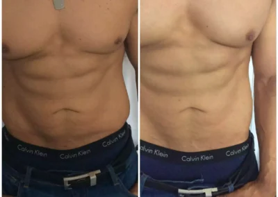 Before After Spray Tanning