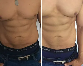 Skincare and Body Treatments San Diego