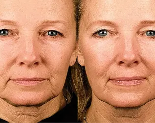 Skincare and Body Treatments San Diego