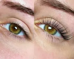 Skincare and Body Treatments San Diego