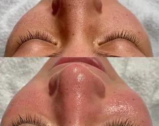 Skincare and Body Treatments San Diego