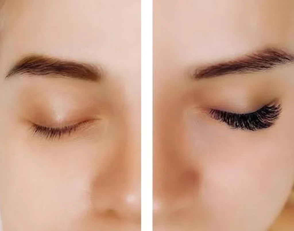 before and after results lash brow