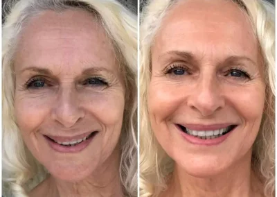 Facial Services San Diego