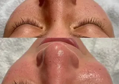 Facial Services San Diego