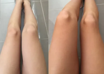 Spray Tanning in San Diego