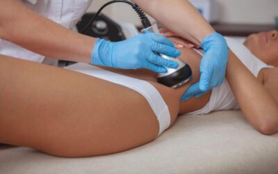 What to know about Ultrasonic Cavitation?