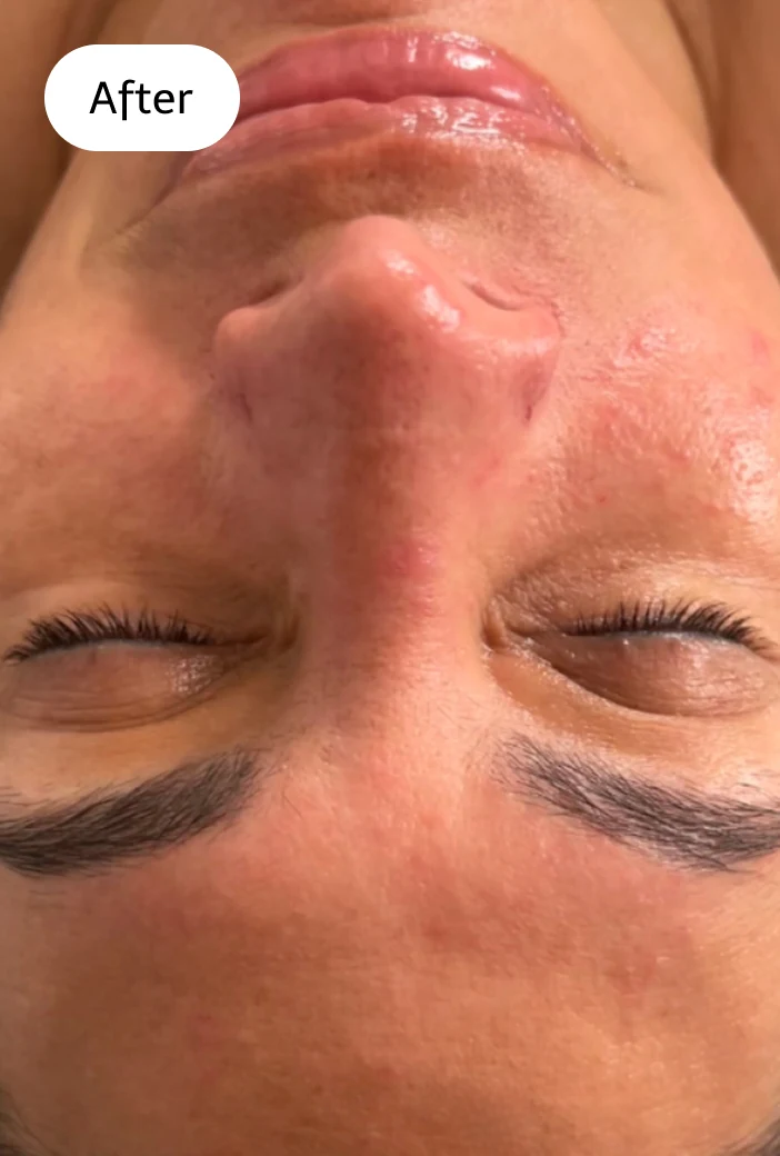 Facial Services San Diego