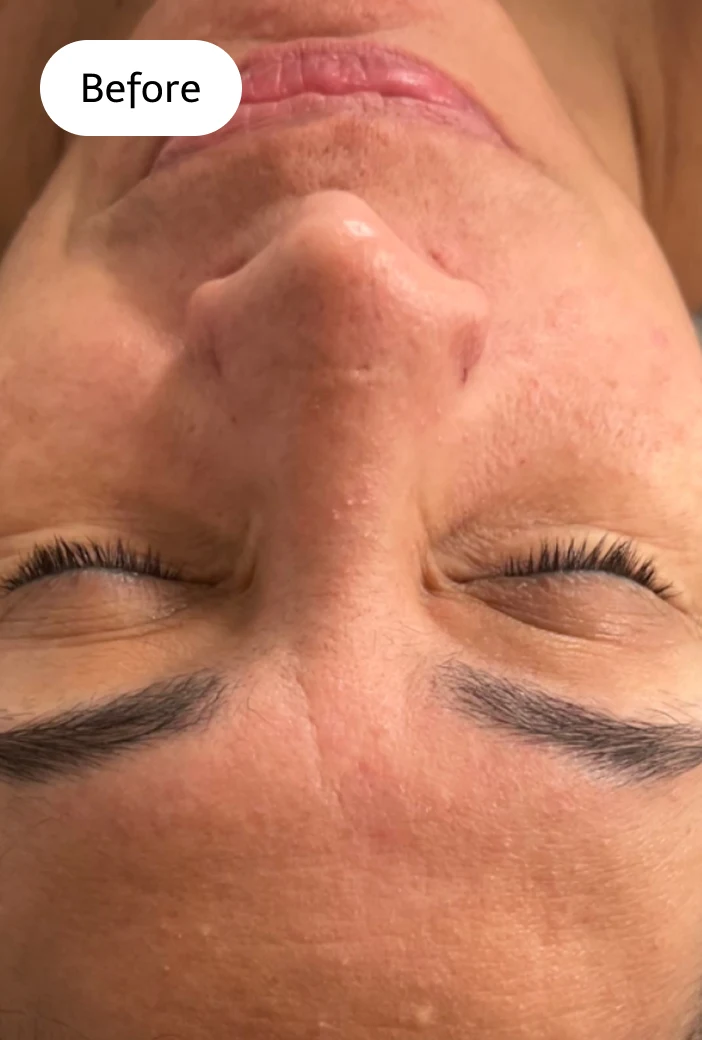 Facial Services San Diego